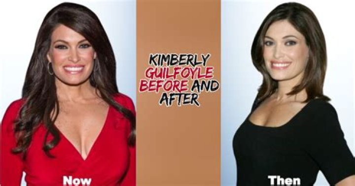 Kimberly Guilfoyle Before and After Images: A Comprehensive Look at Her Transformation