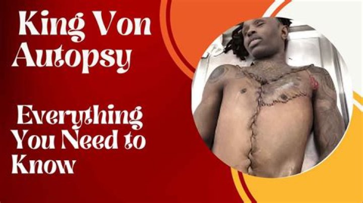 Understanding King Von Autopsy Report: Insights into His Life and Legacy